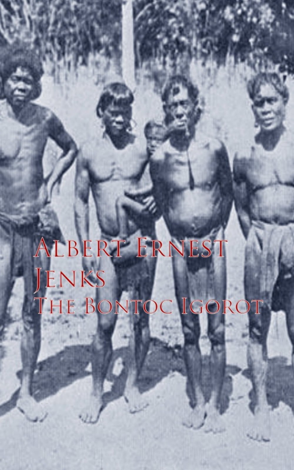 ibs