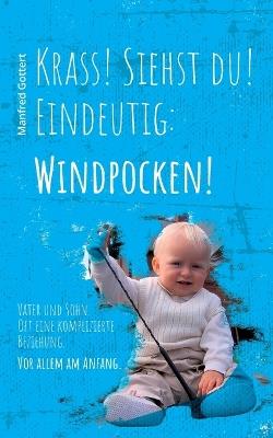 Krass! Siehst du! Eindeutig: Windpocken!: Vater und Sohn. Oft eine komplizierte Beziehung. Vor allem am Anfang. - Manfred Gottert - cover