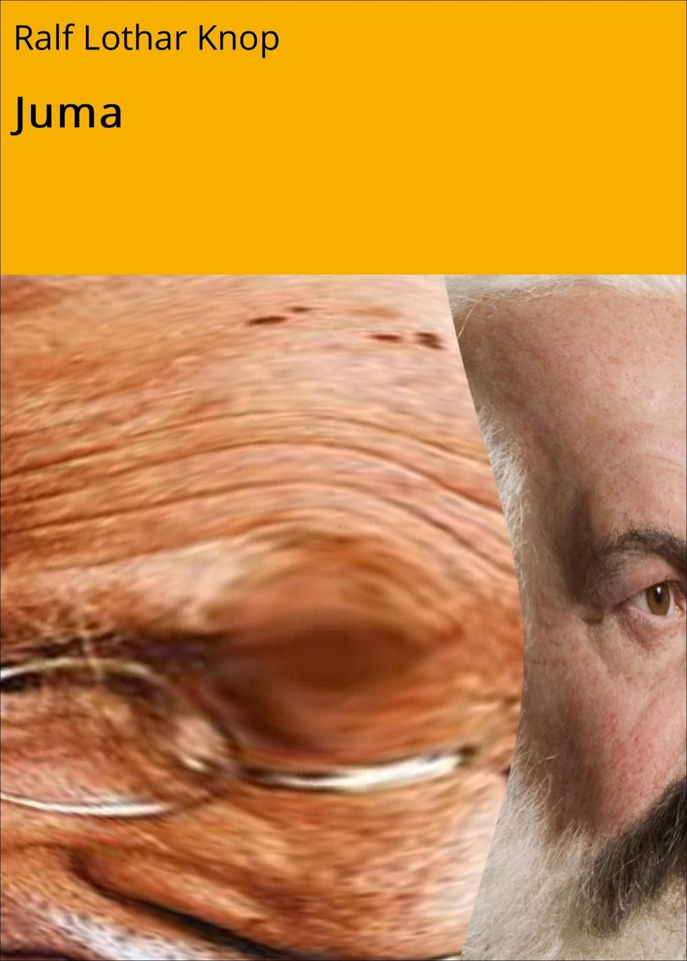ibs