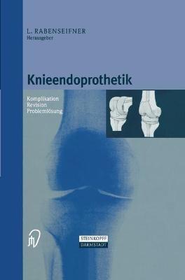 Knieendoprothetik: Komplikation - Revision - Problemlösung - cover