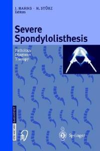 Severe Spondylolisthesis: Pathology-diagnosis-therapy - cover