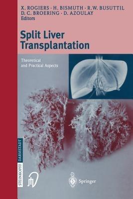 Split liver transplantation: Theoretical and practical aspects - cover