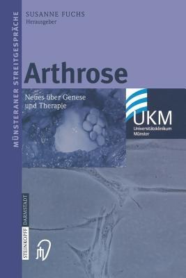 Arthrose: Neues über Genese und Therapie - cover