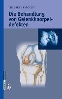 Die Behandlung Von Gelenkknorpeldefekten - Christoph Erggelet - cover
