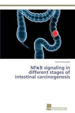 NF?B signaling in different stages of intestinal carcinogenesis