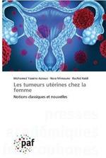 Les tumeurs uterines chez la femme