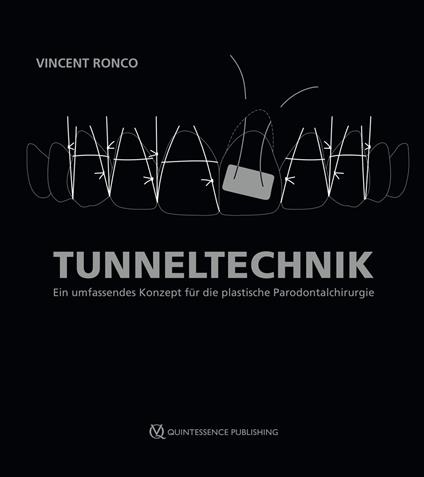 Tunneltechnik