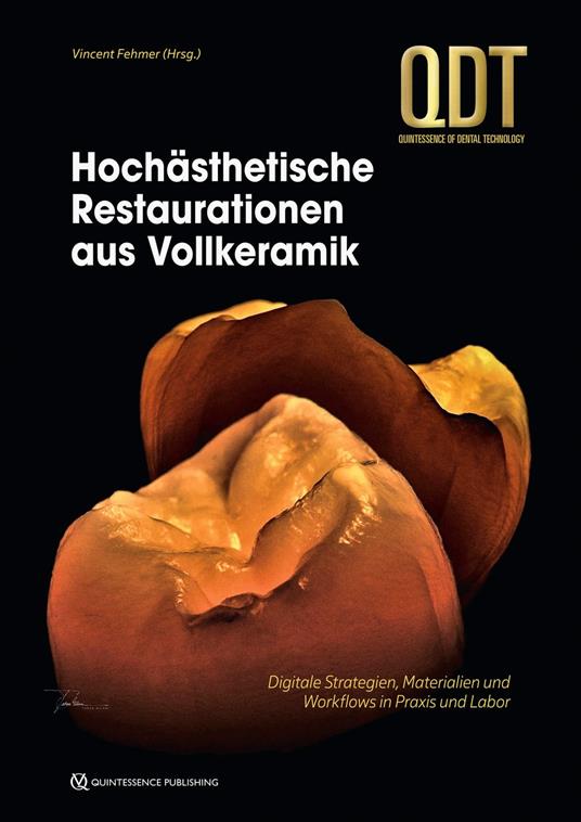 Hochästhetische Restaurationen aus Vollkeramik