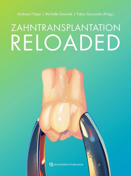 Zahntransplantation Reloaded