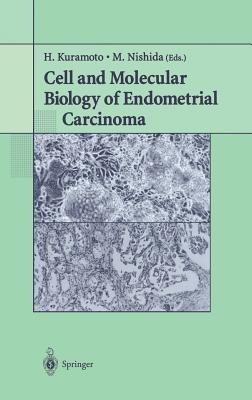 Cell and Molecular Biology of Endometrial Carcinoma - cover