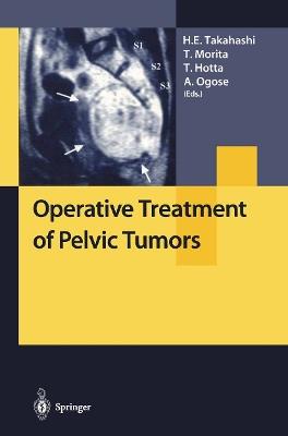 Operative Treatment of Pelvic Tumors - cover