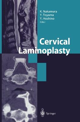 Cervical Laminoplasty - cover