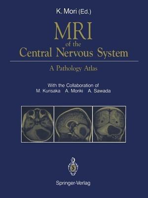 MRI of the Central Nervous System: A Pathology Atlas - cover