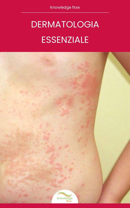 Dermatologia Essenziale - Knowledge flow - ebook