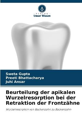 Beurteilung der apikalen Wurzelresorption bei der Retraktion der Frontzähne - Sweta Gupta,Preeti Bhattacharya,Juhi Ansar - cover