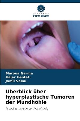 Überblick über hyperplastische Tumoren der Mundhöhle - Maroua Garma,Hajer Henteti,Jamil Selmi - cover