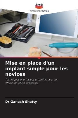 Mise en place d'un implant simple pour les novices - Ganesh Shetty - cover
