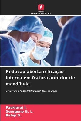 Redução aberta e fixação interna em fratura anterior de mandíbula - Packiaraj I,Georgeno G L,Balaji G - cover