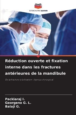 Réduction ouverte et fixation interne dans les fractures antérieures de la mandibule - Packiaraj I,Georgeno G L,Balaji G - cover