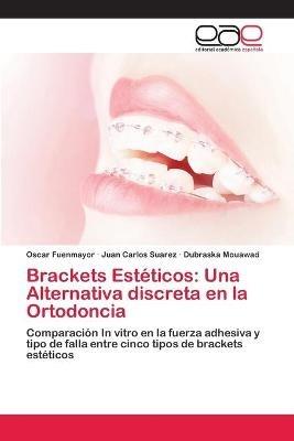 Brackets Esteticos: Una Alternativa discreta en la Ortodoncia - Oscar Fuenmayor,Juan Carlos Suarez,Dubraska Mouawad - cover