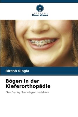 Bögen in der Kieferorthopädie - Ritesh Singla - cover