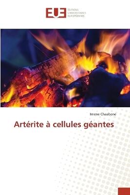Artérite à cellules géantes - Imene Chaabene - cover
