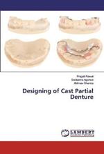 Designing of Cast Partial Denture