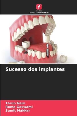 Sucesso dos implantes - Tarun Gaur,Roma Goswami,Sumit Makkar - cover