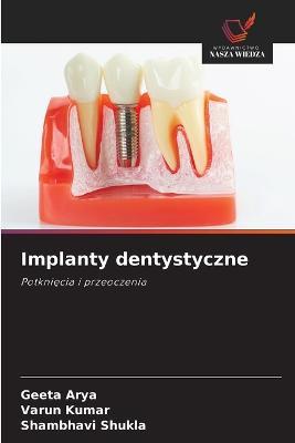 Implanty dentystyczne - Geeta Arya,Varun Kumar,Shambhavi Shukla - cover