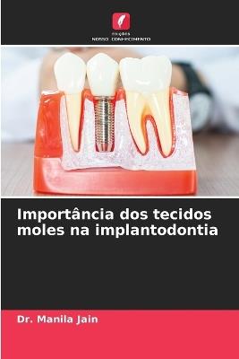 Importância dos tecidos moles na implantodontia - Manila Jain - cover