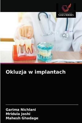 Okluzja w implantach - Garima Nichlani,Mridula Joshi,Mahesh Ghadage - cover