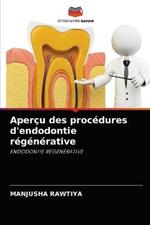 Apercu des procedures d'endodontie regenerative