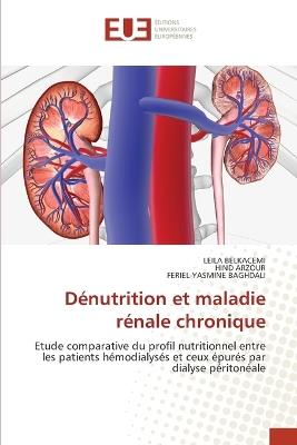 D?nutrition et maladie r?nale chronique - Leila Belkacemi,Hind Arzour,Feriel-Yasmine Baghdali - cover