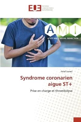 Syndrome coronarien aigue ST+ - Amal Samet - cover