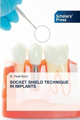 Socket Shield Technique in Implants - Palak Boob - cover
