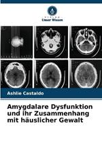 Amygdalare Dysfunktion und ihr Zusammenhang mit h?uslicher Gewalt