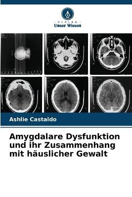 Amygdalare Dysfunktion und ihr Zusammenhang mit h?uslicher Gewalt - Ashlie Castaldo - cover