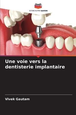 Une voie vers la dentisterie implantaire - Vivek Gautam - cover
