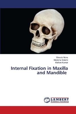 Internal Fixation in Maxilla and Mandible - Shweta Nehe,Manisha Solanki,Kishan Kumar - cover