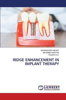 Ridge Enhancement in Implant Therapy - Shashikanth Hegde,Mohamed Nawfal,Rajesh K S - cover