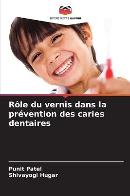 R?le du vernis dans la pr?vention des caries dentaires - Punit Patel,Shivayogi Hugar - cover
