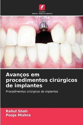 Avan?os em procedimentos cir?rgicos de implantes - Rahul Shah,Pooja Mishra - cover