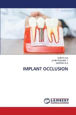 Implant Occlusion - Surya A R,John Roshan T,Adersh G a - cover