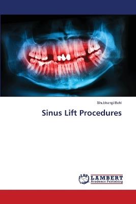 Sinus Lift Procedures - Shubhangi Behl - cover