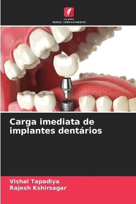 Carga imediata de implantes dent?rios - Vishal Tapadiya,Rajesh Kshirsagar - cover