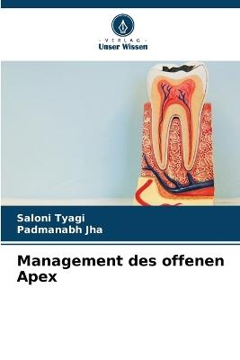Management des offenen Apex - Saloni Tyagi,Padmanabh Jha - cover