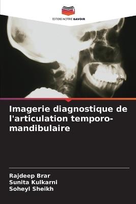 Imagerie diagnostique de l'articulation temporo-mandibulaire - Rajdeep Brar,Sunita Kulkarni,Soheyl Sheikh - cover