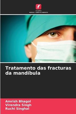 Tratamento das fracturas da mand?bula - Amrish Bhagol,Virendra Singh,Ruchi Singhal - cover