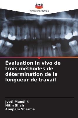 ?valuation in vivo de trois m?thodes de d?termination de la longueur de travail - Jyoti Mandlik,Nitin Shah,Anupam Sharma - cover