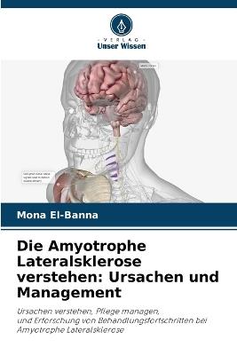 Die Amyotrophe Lateralsklerose verstehen: Ursachen und Management - Mona El-Banna - cover
